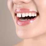 can cosmetic dentistry fix gaps without braces