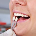 are dental crowns the best for restoring teeth