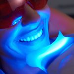 what are the latest teeth whitening advancements