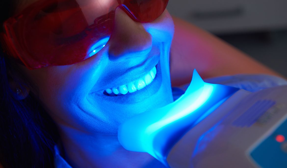 what are the latest teeth whitening advancements